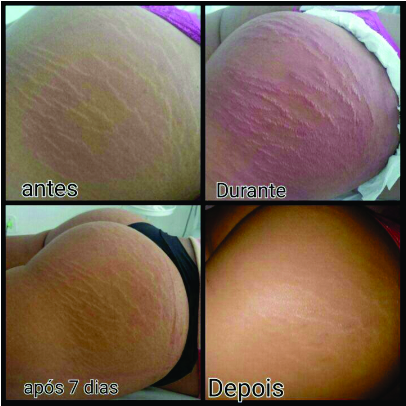 imagem do produto 6