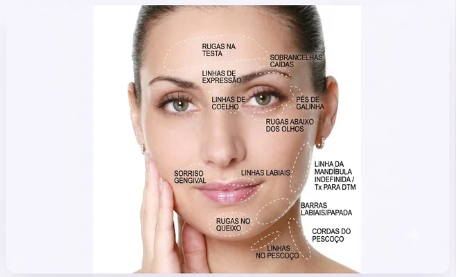 Toxina Botulínica "Botox"