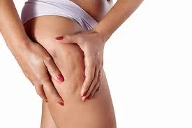 Celulite e Lipedema