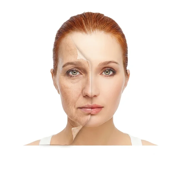Rejuvenescimento Facial